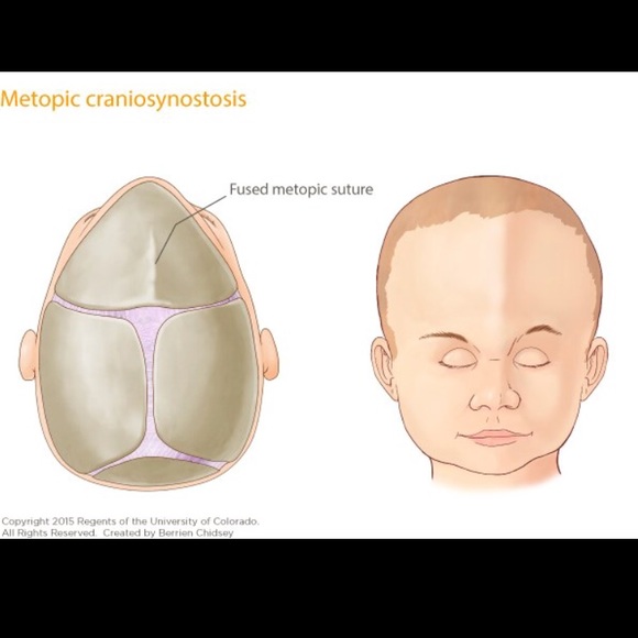 Awareness 💜 - Picture 3 of 3